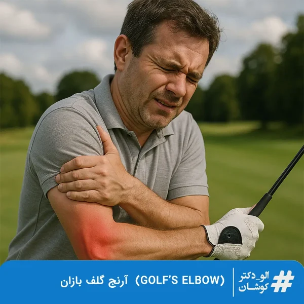 آرنج گلف بازان یا گلف البو (Golf’s Elbow)