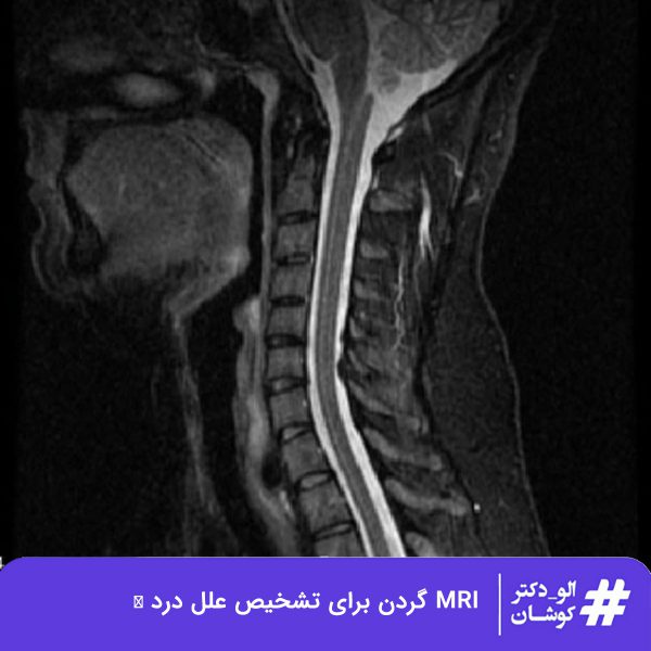 MRI گردن
