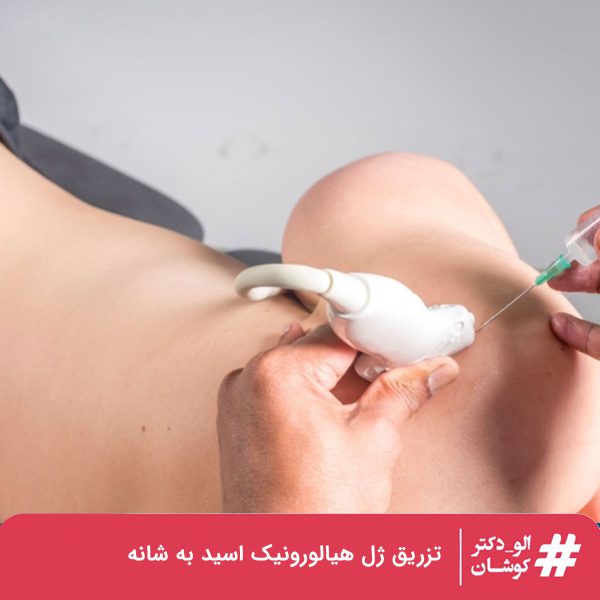 تزریق ژل هیالورونیک اسید به شانه