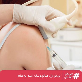 تزریق ژل هیالورونیک اسید به شانه