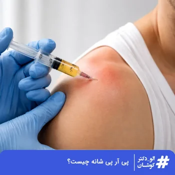 پی آر پی شانه
