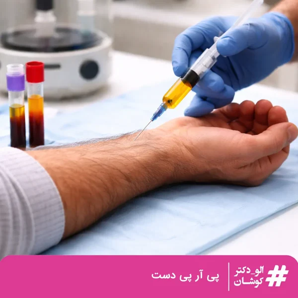 پی آر پی دست