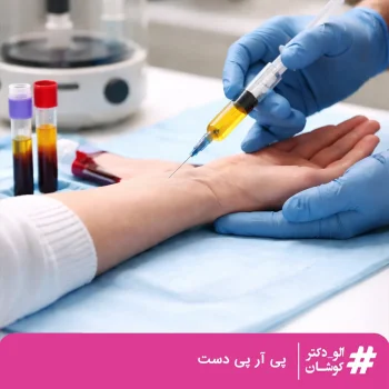 پی آر پی دست
