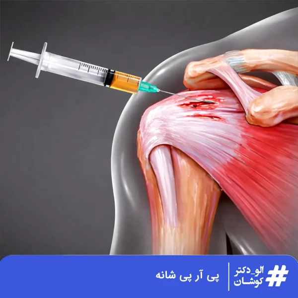 پی آر پی شانه