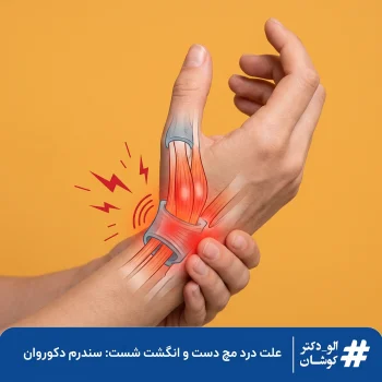 سندرم دکوروان، درد مچ دست