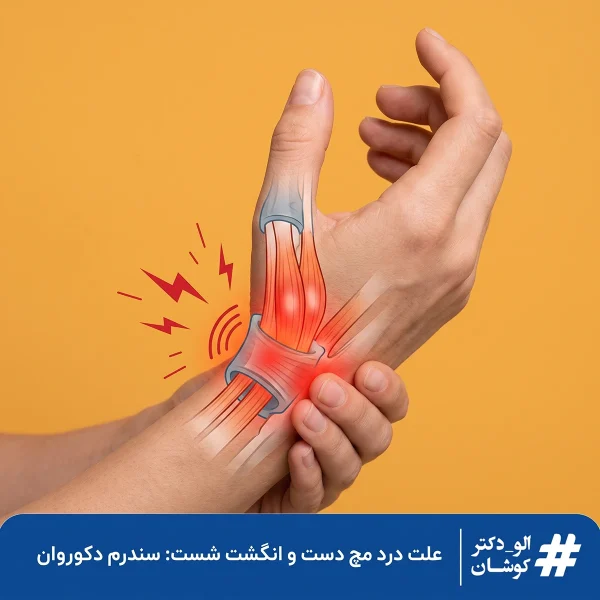 سندرم دکوروان، درد مچ دست