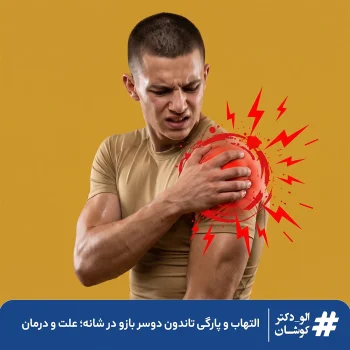 پارگی و التهاب تاندون دوسر بازو
