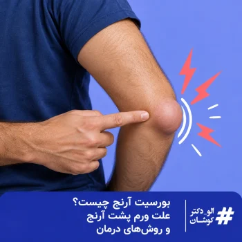 تورم موضعی روی نوک پشتی آرنج با اشاره به بورسیت