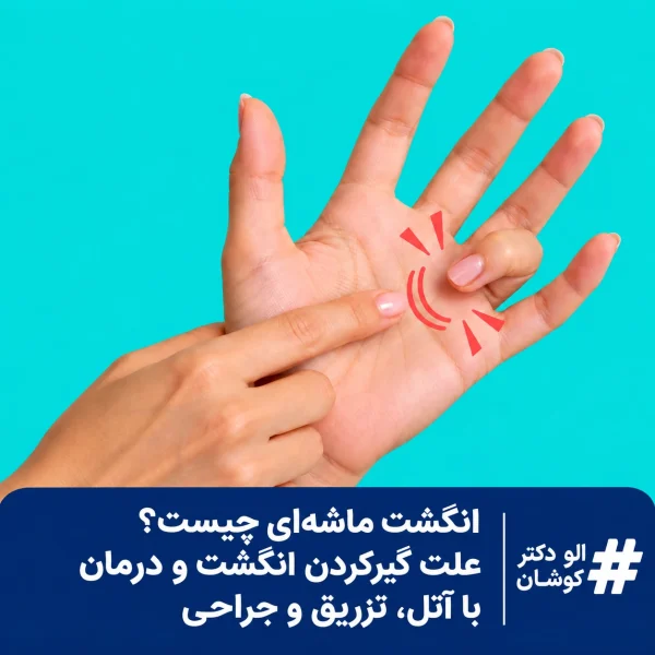 انگشت ماشه ای
